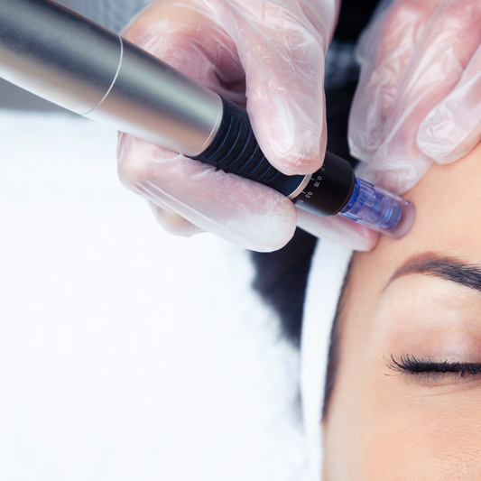 Microneedling