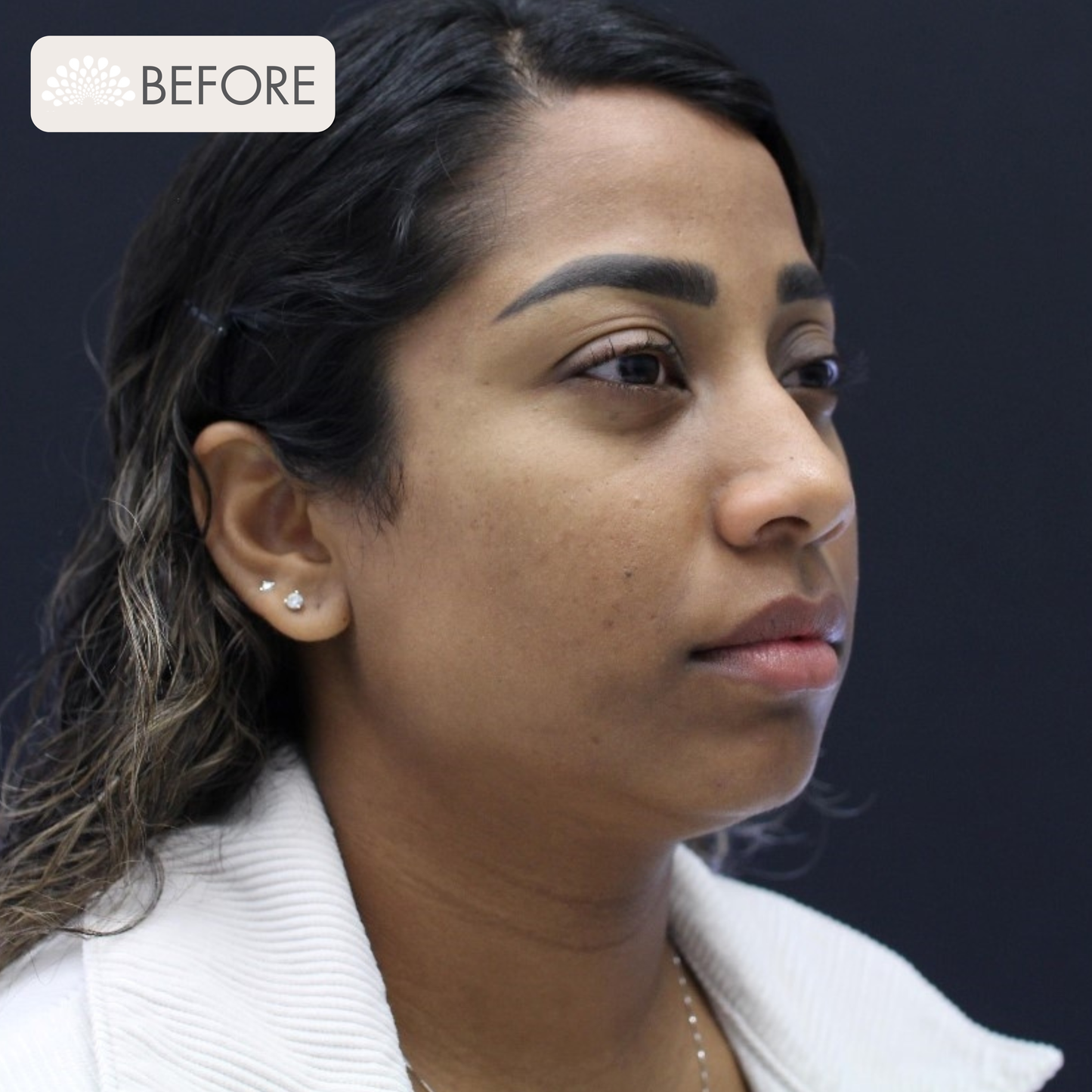 HA Enhancement Package