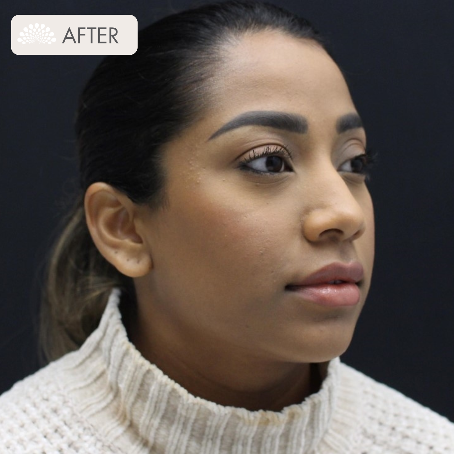 HA Enhancement Package